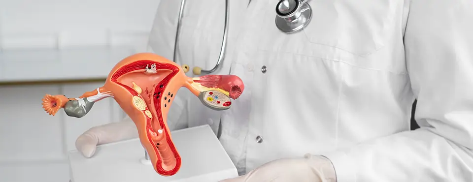 Doctor explaining ovarian cancer using reproductive system model
