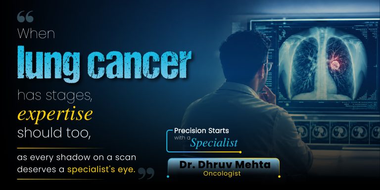 lung cancer specialist
